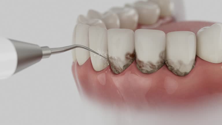 Trusted Wisdom Tooth Removal service in Benton, IL - Dentist Open Now